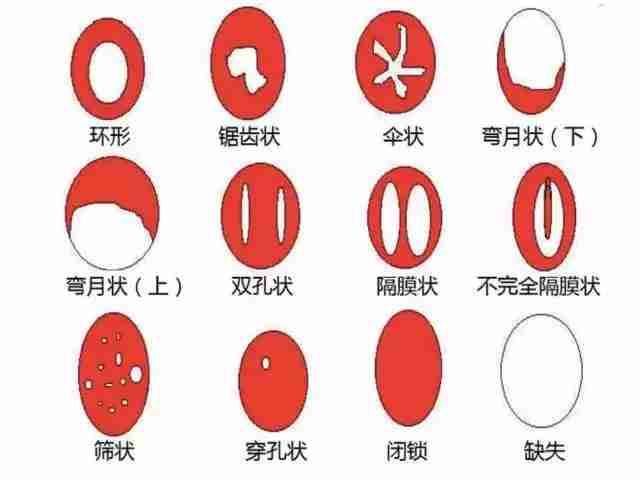 女人的第一次到底有多疼(羞羞的第一次为什么会感到疼?)