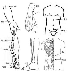 拔火罐拔哪里(拔火罐的方法和位置)